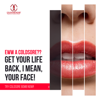 Cold Sore Treatment with Dragon's Blood | Coldsore Bomb